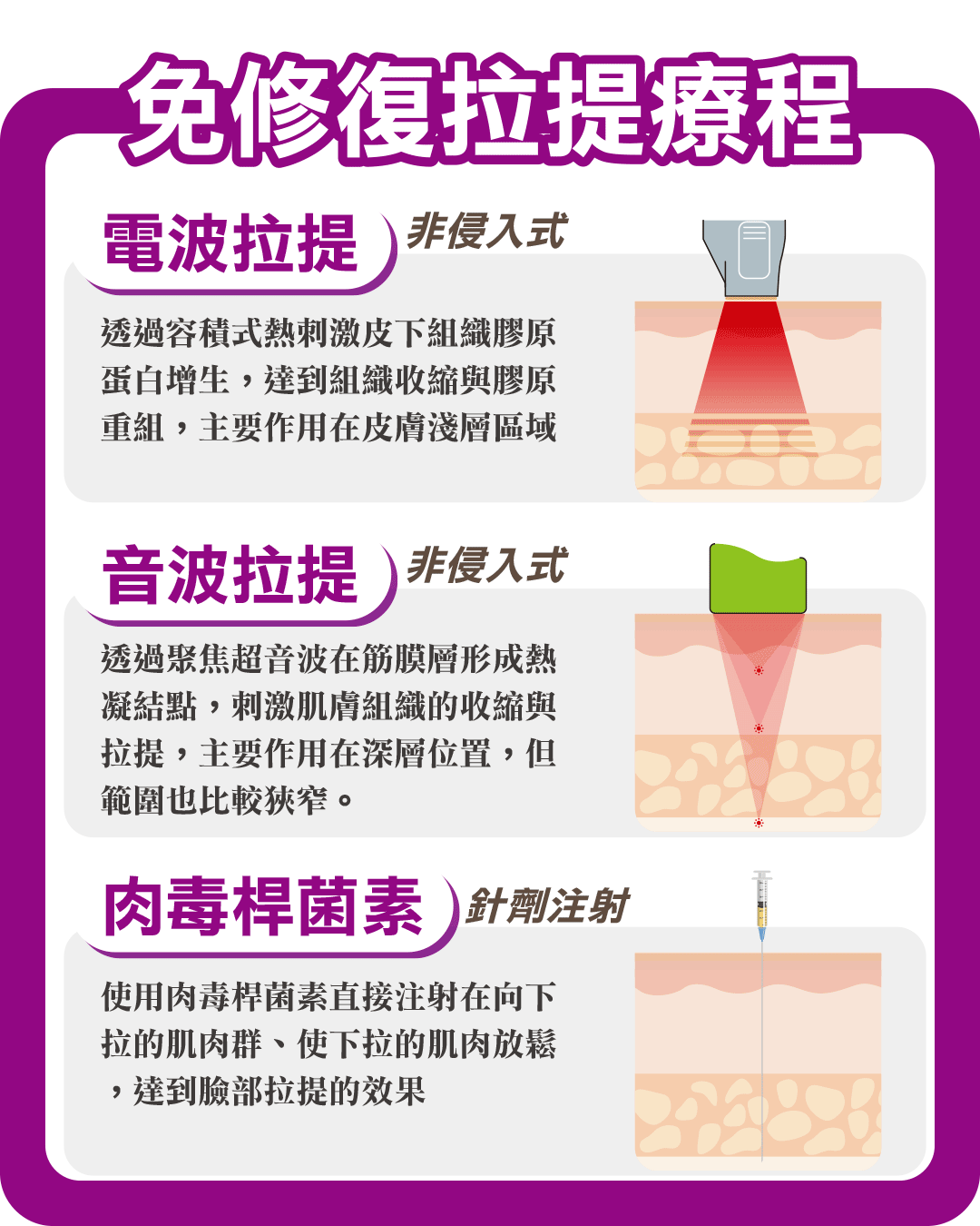 免修復拉提療程|電波拉提|音波拉提|肉毒桿菌素 免修復拉提療程|電波拉提|音波拉提|肉毒桿菌素