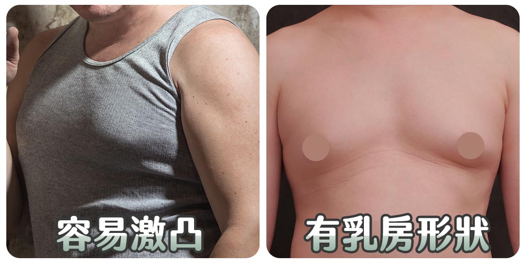 男性女乳症困擾|容易激凸|有乳房形狀