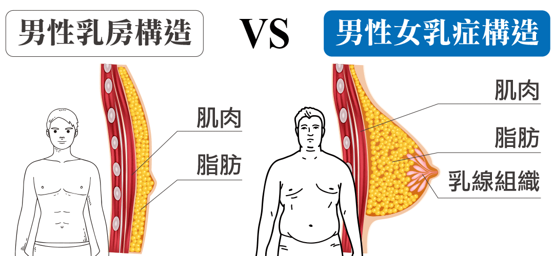 周爾康整形外科診所男性女乳症介紹|男性乳房構造