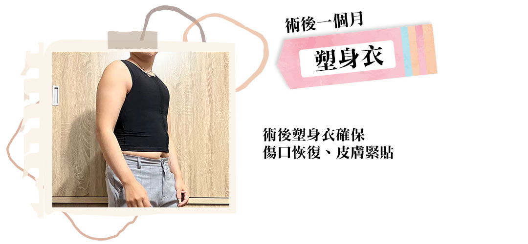 平胸手術推薦醫師周爾康醫師|平胸手術實際流程08 平胸手術推薦醫師周爾康醫師|平胸手術實際流程08